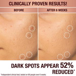 Charlotte Tilbury Dark Spot Correcting Radiance Recovery Serum 10ml